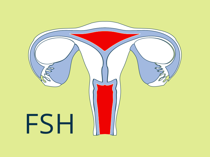 Follikelstimulierendes Hormon, follikelstimulierendes Hormon, FSH, follikelstimulierender Hormonmangel, follikelstimulierender Hormonüberschuss