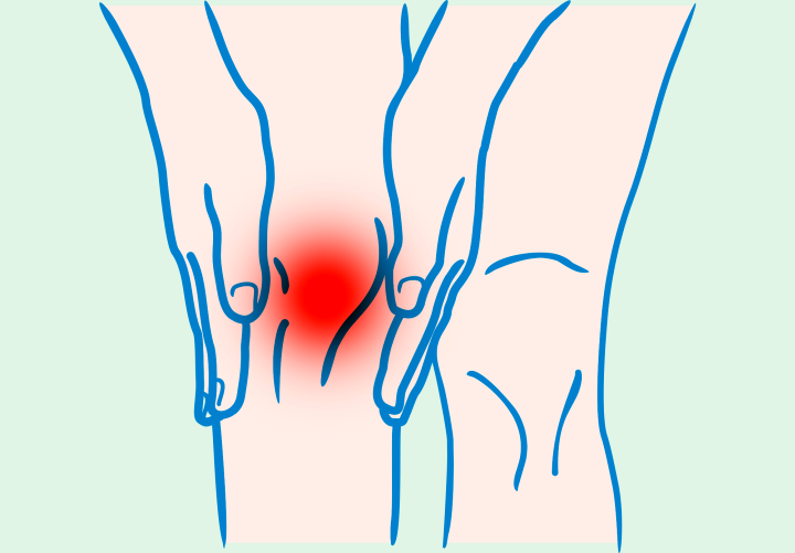 Rheumatismus, RA (Rheumatoide Arthritis), Rheumatoide Gelenkentzündung