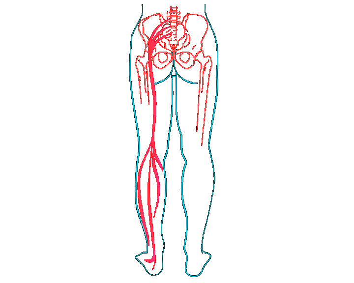 Rwa kulszowa, nerw kulszowy, noga, nerwy, układ nerwowy