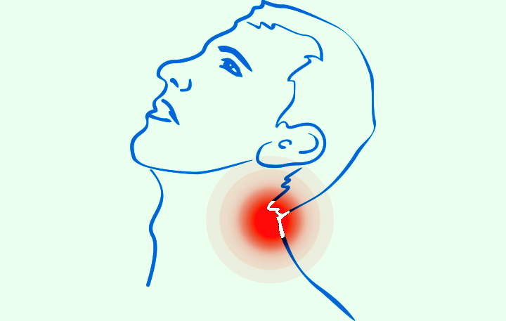 Cervical spine pain, neck, nape, head, migraine, lordosis