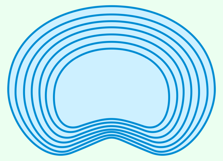 Intervertebral disc, spinal disc, disc herniation, discopathy