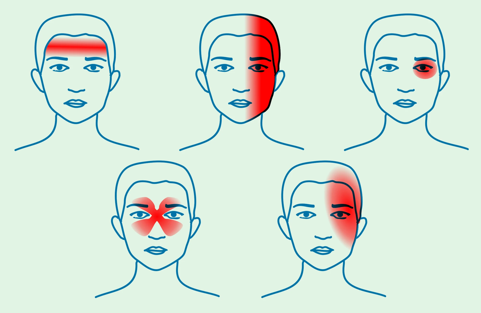 Headache Map, Types of Pain, Neurological Treatment