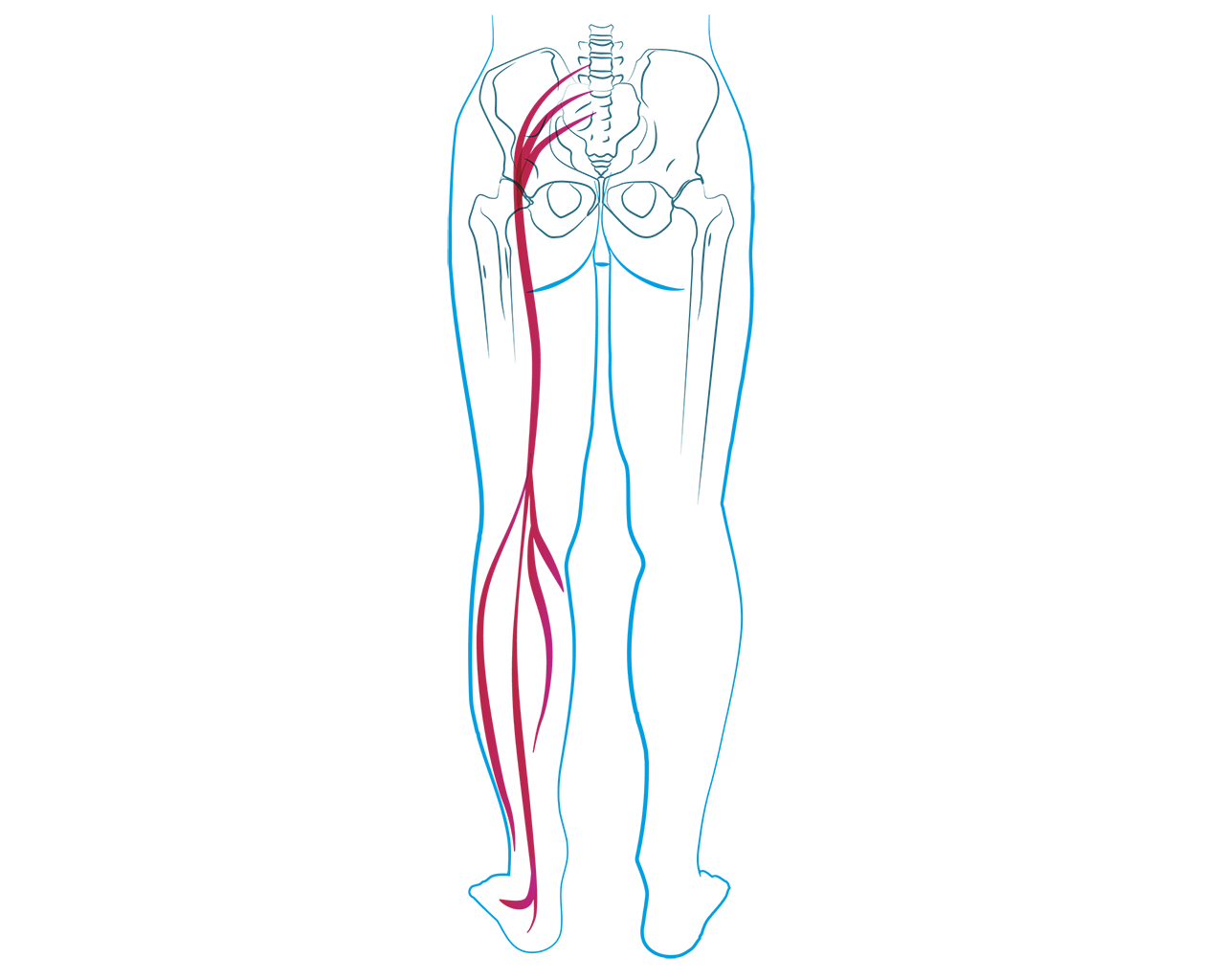 Rwa kulszowa, nerw kulszowy, noga, nerwy, układ nerwowy