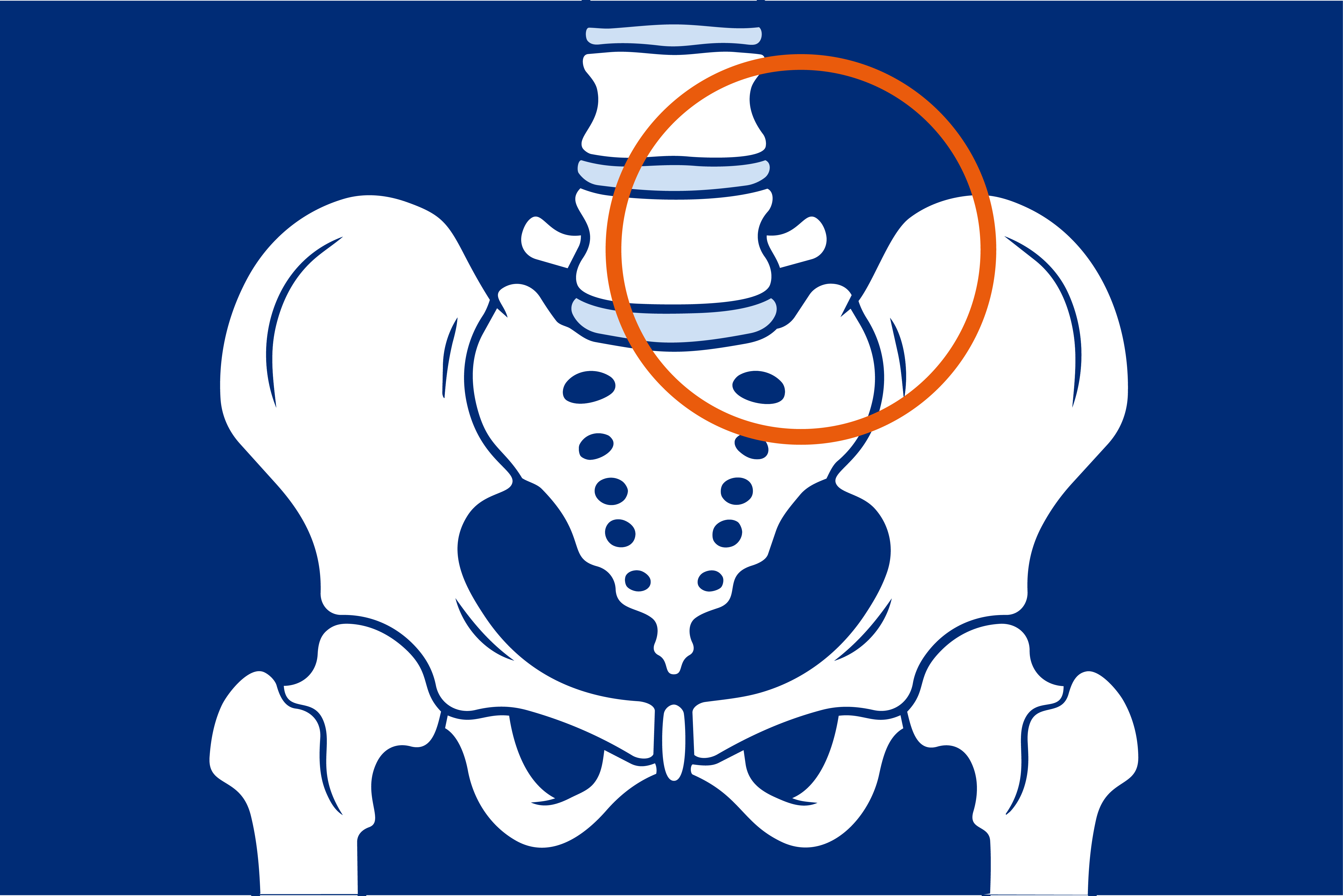 lumbalizacja kręgu, przyczyny lumbalizacji, choroba kręgosłupa