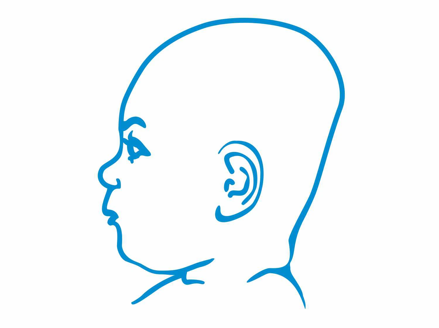 Płaska główka u dziecka, płaskogłowie, asymetryczna głowa